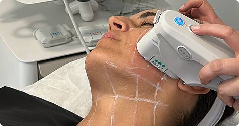 Equipo Ultherapy Lifting aprobado por la FDA